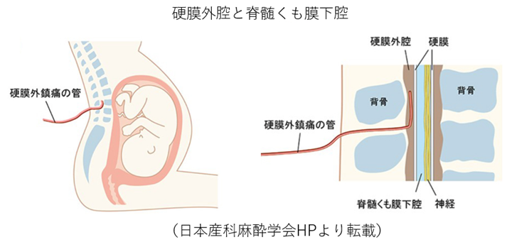 無痛分娩-p01_硬膜外腔と脊髄くも膜下腔